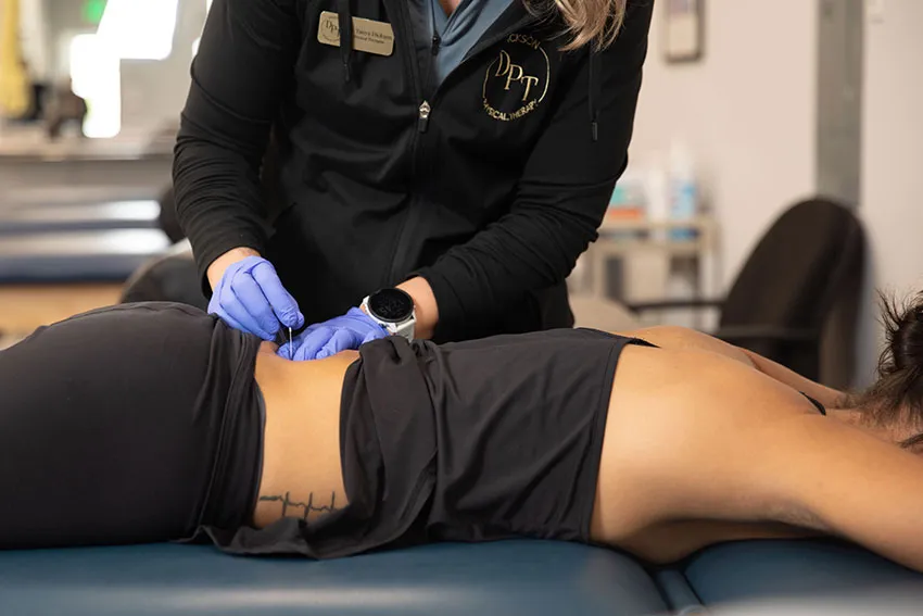 Dry needling treatment at Dickson Physical Therapy in Salisbury, MD