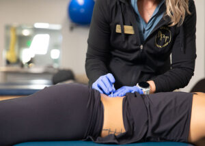 Dry Needling - Dickson Physical Therapy